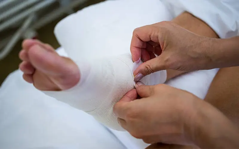 Diabetic limb salvage