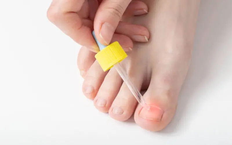 Treatment for Toenail Fungus