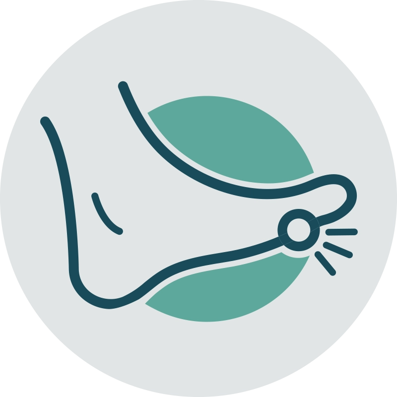 Upperline Health Bunions Upperline Health Bunions