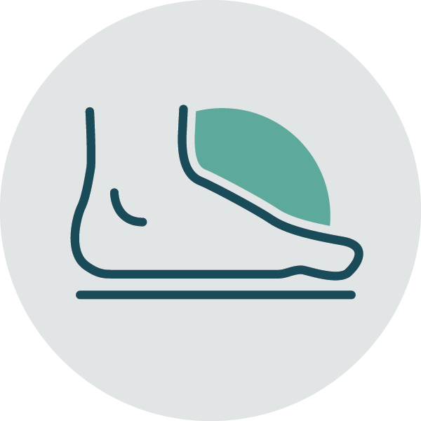 Flat Foot Flat Foot